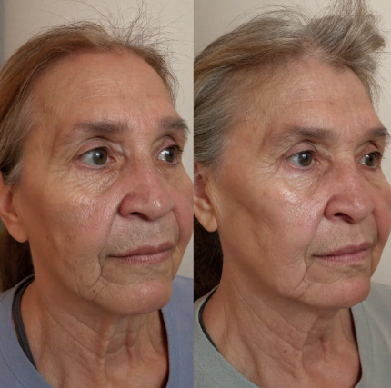 Customer-submitted before and after comparison