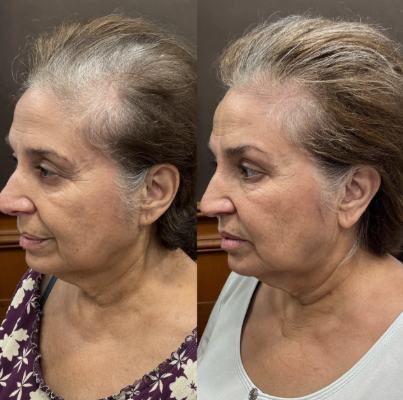 Customer-submitted before and after comparison