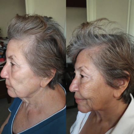 Customer-submitted before and after comparison
