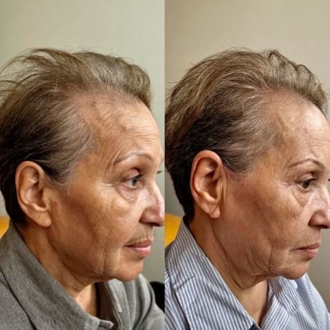 Customer-submitted before and after comparison